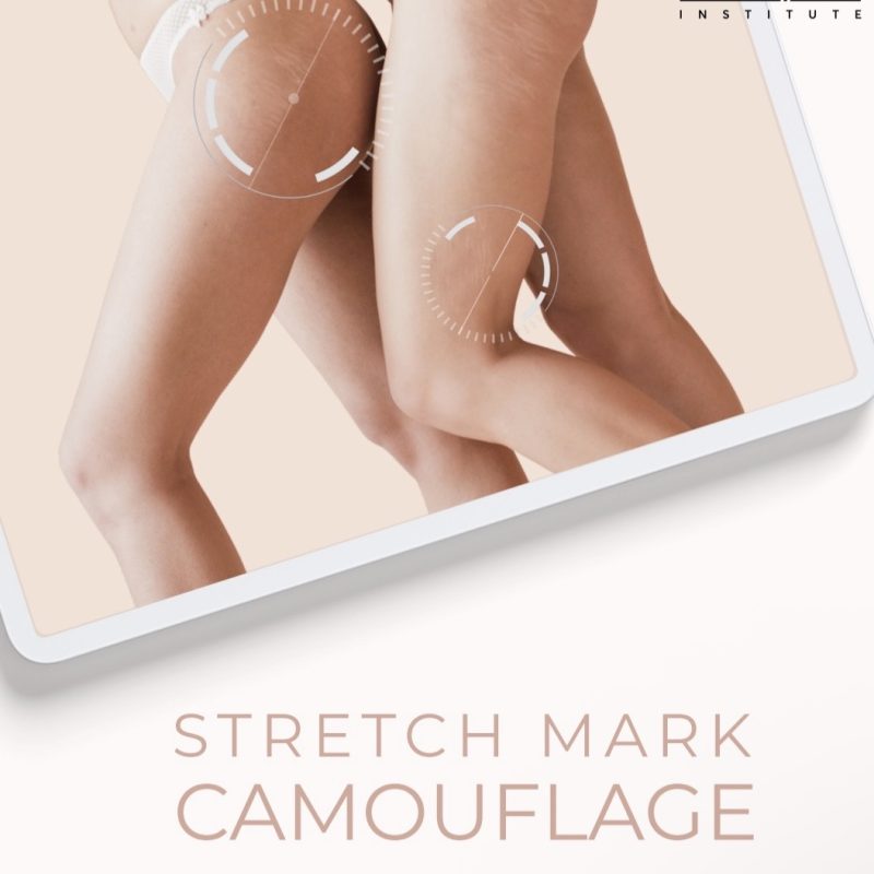 Online Course for Stretch Mark Camouflage